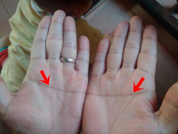 Bàn tay có đường chỉ tay ngang bên phải có ý nghĩa gì?